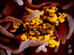 Coronavirus Coronavirus