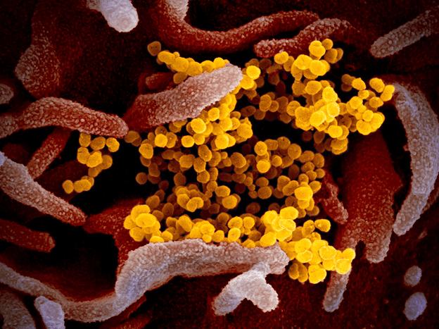 Coronavirus